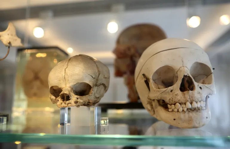 BERLIN, GERMANY - JUNE 20: Human skulls are seen on display at an anatomical history exhibition on June 20, 2016 in Berlin, Germany. The city of Berlin features several macabre museums, including those dedicated to torture from medieval times through the Nazi period, as well as a permanent exhibition of anatomist Gunther von Hagens' plastified corpses. (Photo by Adam Berry/Getty Images)