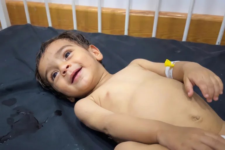 صورة رقم (7) فلسطين غزة- مدينة غزة- مستشفى أصدقاء المريض، عدي حبيب، غاب حليب أمه، وشحّ الحليب الصناعي في غزة المحاصرة، وعدي واحد من آلاف الأيتام الذين طاردهم الجوع بعد أن نجوا من القصف الإسرائيلي، 15/أكتوبر 2026 إسراء الرّملي- خاص بنيوز عربي